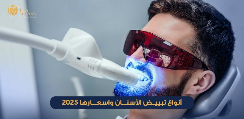 أنواع تبييض الأسنان واسعارها