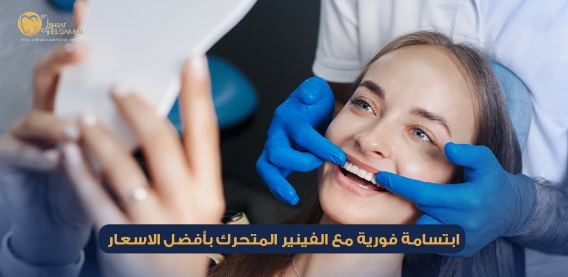 سعر فينير متحرك