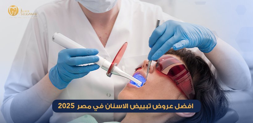 عروض تبييض الاسنان
