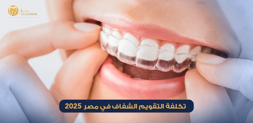 سعر التقويم الشفاف