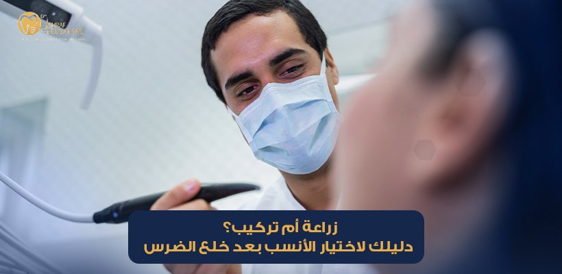 تركيب ضرس مكان المخلوع