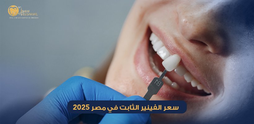 سعر الفينير الثابت في مصر