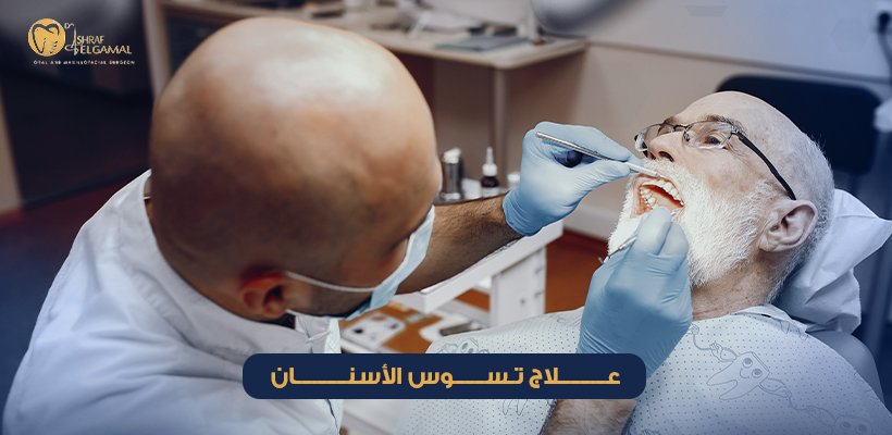 علاج تسوس الأسنان