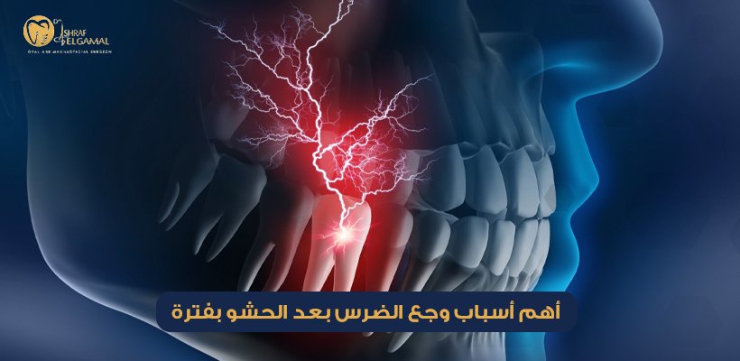 أسباب وجع الضرس بعد الحشو بفترة