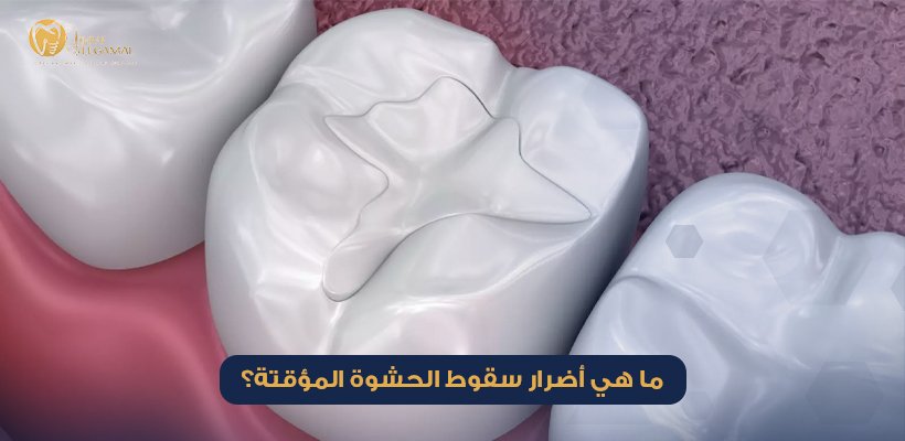 أضرار سقوط الحشوة المؤقتة