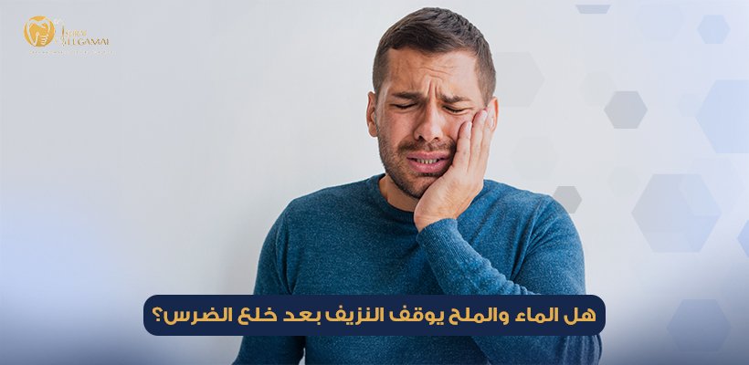 هل الماء والملح يوقف النزيف بعد خلع الضرس