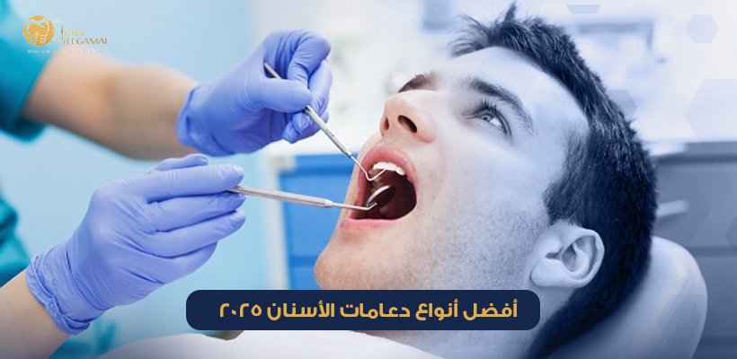 أفضل أنواع دعامات الأسنان