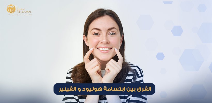 الفرق بين ابتسامة هوليود و الفينير