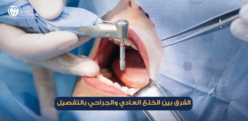 الفرق بين الخلع العادي والجراحي