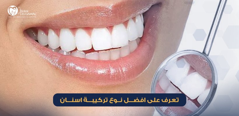 افضل نوع تركيبة اسنان