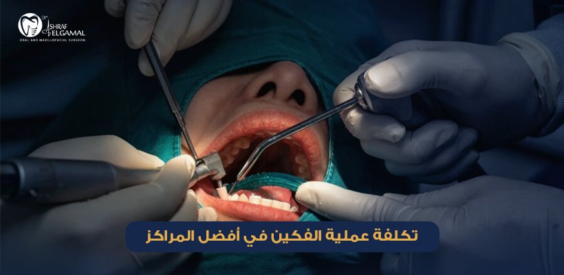 تكلفة عملية الفكين