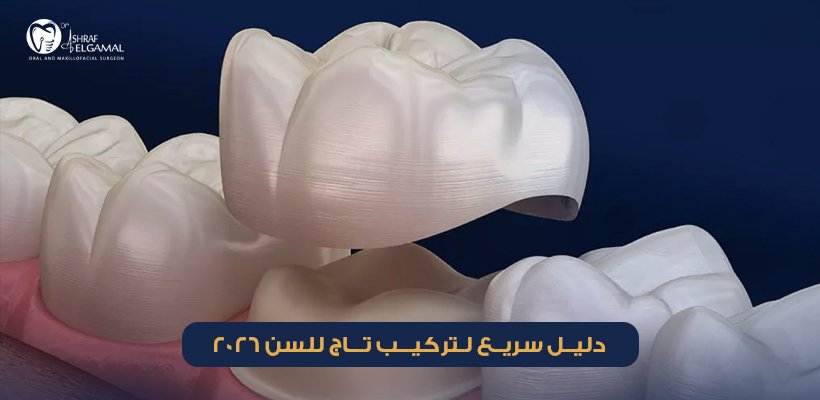 تركيب تاج للسن