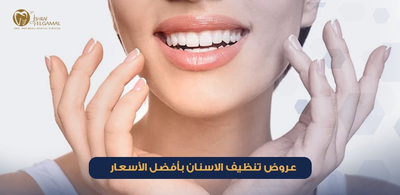 عروض تنظيف الاسنان