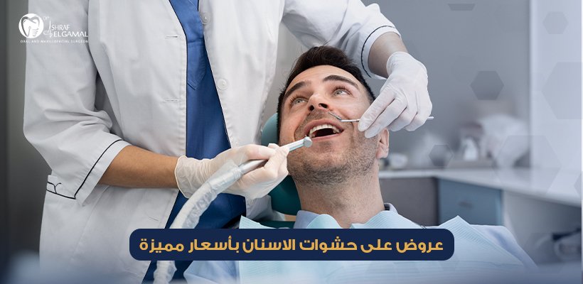 عروض على حشوات الاسنان