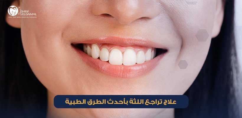 علاج تراجع اللثة