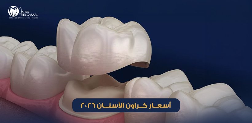 أسعار كراون الأسنان