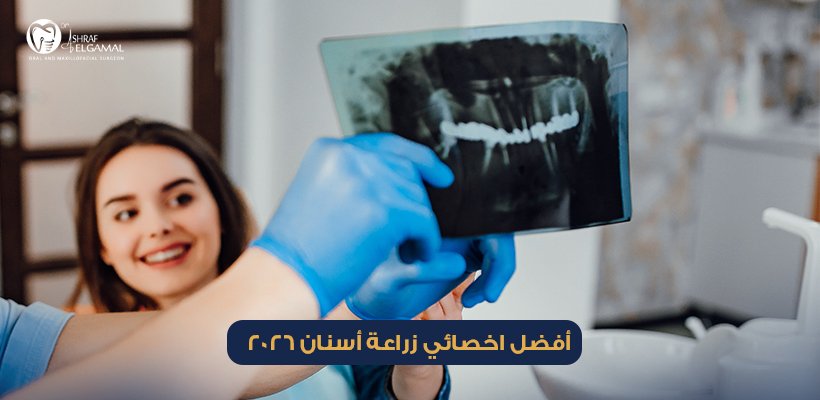 اخصائي زراعة أسنان