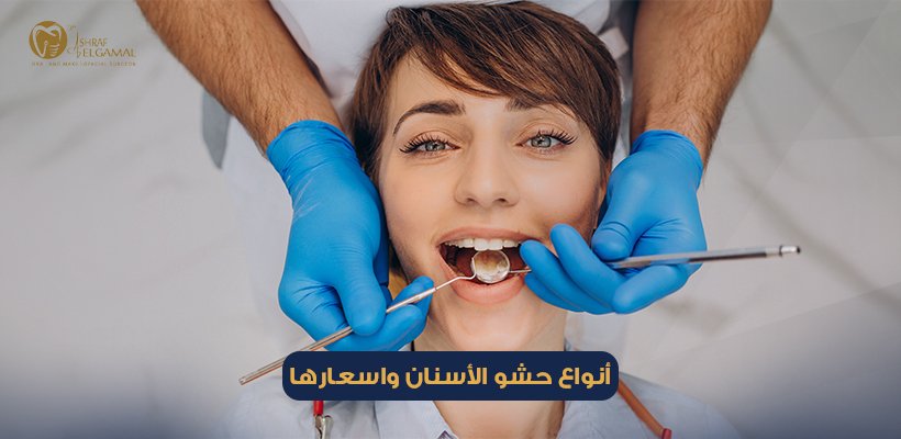 أنواع حشو الأسنان واسعارها