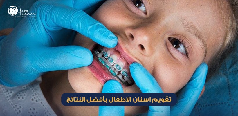 تقويم اسنان الاطفال