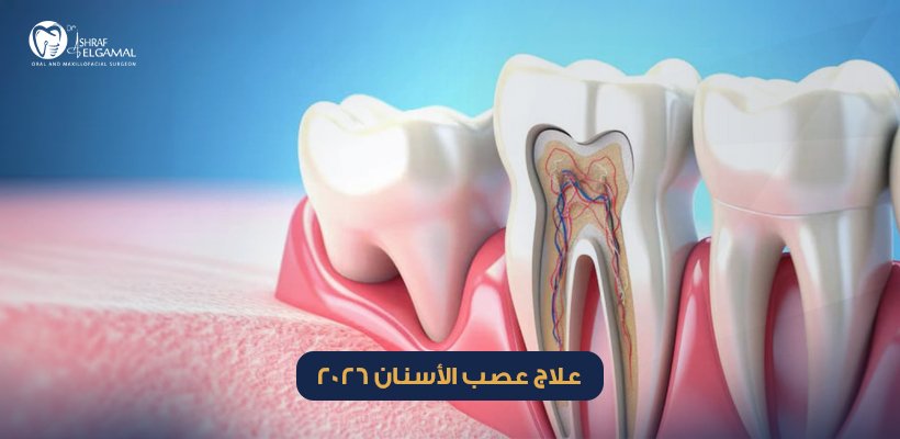 علاج عصب الأسنان