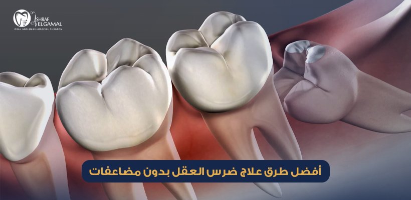 علاج ضرس العقل