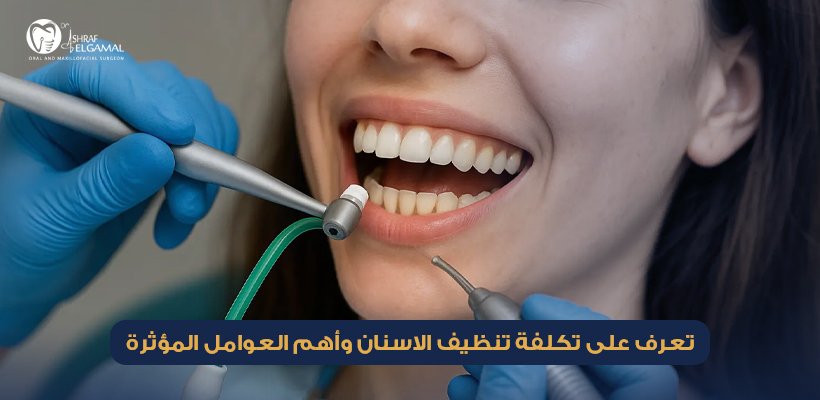 تكلفة تنظيف الاسنان