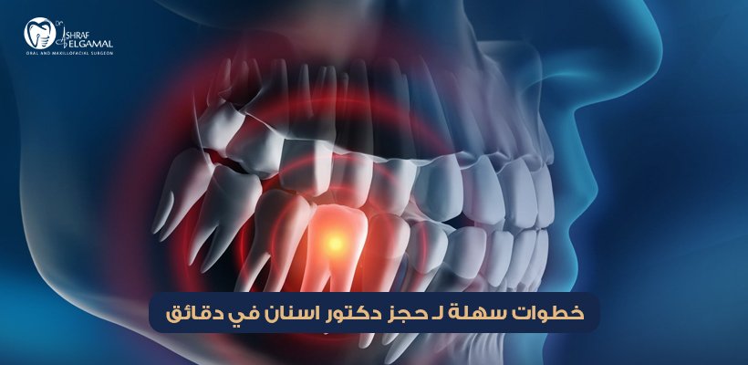 حجز دكتور اسنان