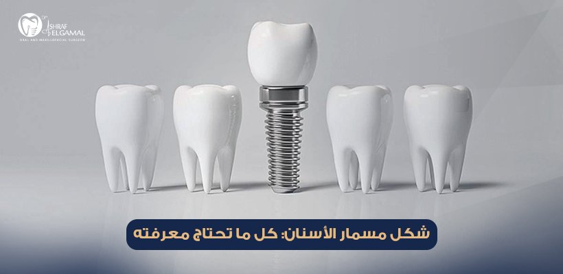 شكل مسمار الأسنان