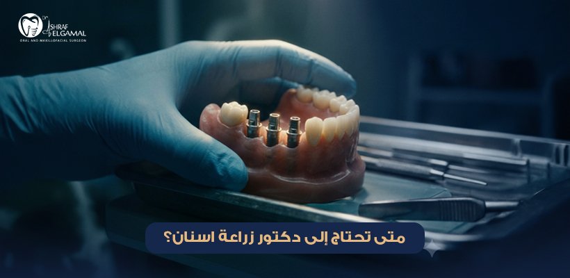 دكتور زراعة اسنان