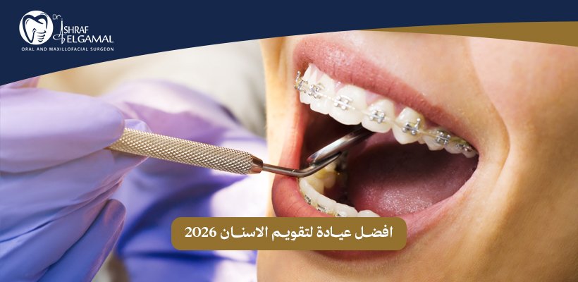 افضل عيادة لتقويم الاسنان