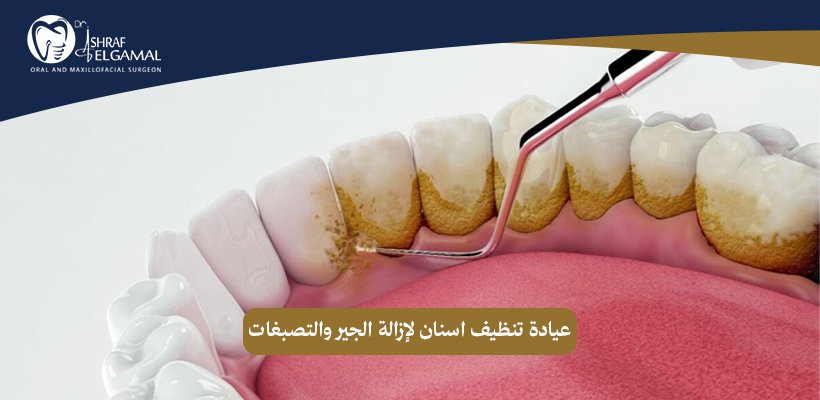 عيادة تنظيف اسنان